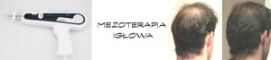 Mezoterapia_igłowa